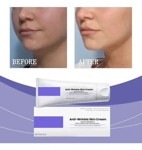 Crema Antiedad Antiarrugas Hidratante Y Reafirmante Para Ros