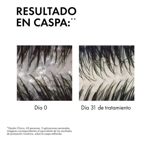 Dercos Shampoo Anticaspa Seca 200ml Vichy