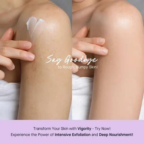 Crema Exfoliante Vigority Kp Bump Eraser 150 Ml
