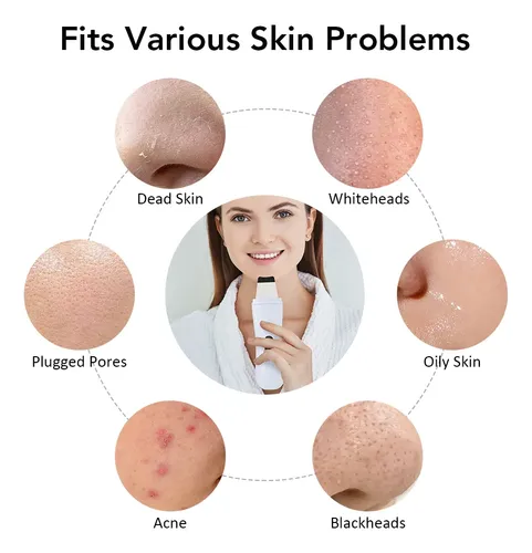 Depurador Facial Profundo Facial Con Exfoliación Ultrasónica A Má White
