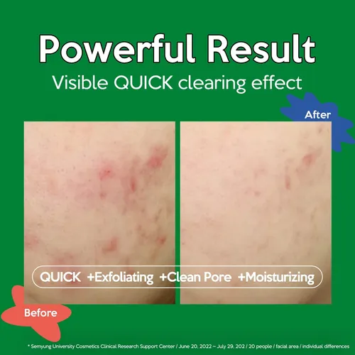 Almohadilla De Tóner Trouless Clear Face 60 Pastillas Tea Tr