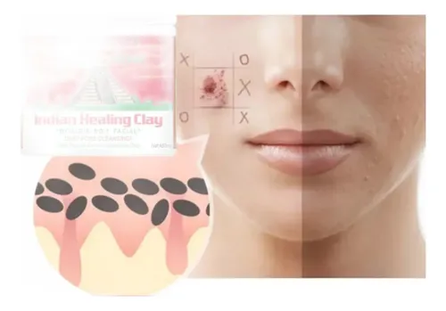 Mascarilla Facial De Arcilla India En Polvo Compatible Con P