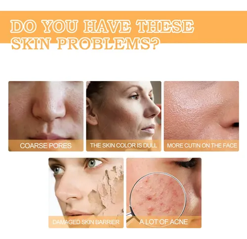 -d/ Tónico Exfoliante Original Con Ácido Glicólico Al 7 ,]