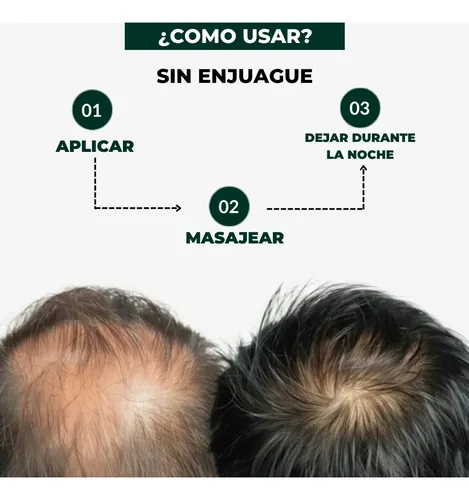 Serum Anticaída Skinfinity X3 + Cepillo Masajeador