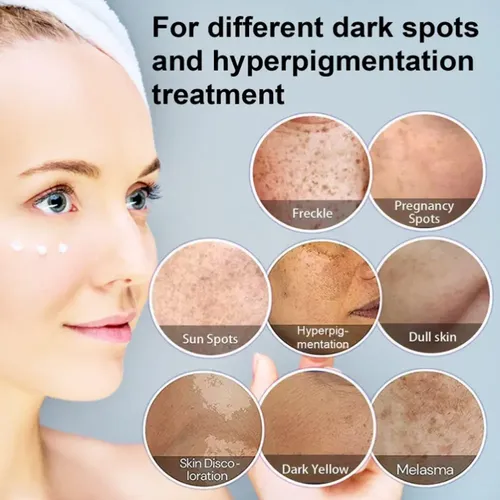 C Elimina Las Manchas Faciales: Melasma, Pecas, Qcc
