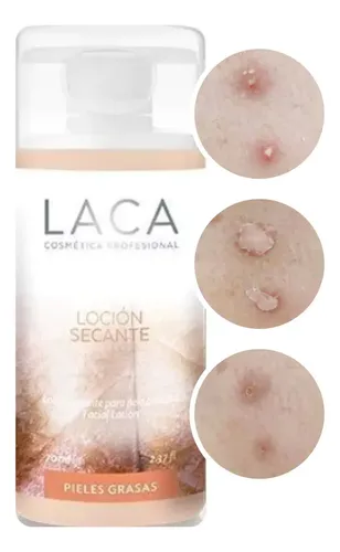 Loción Secante Laca Pieles Grasas Momento de aplicación Día/Noche Tipo de piel Grasa