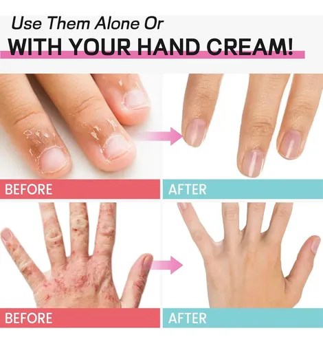 Guantes Spa Hidratantes Furtaa Con Gel Y Vitamina E