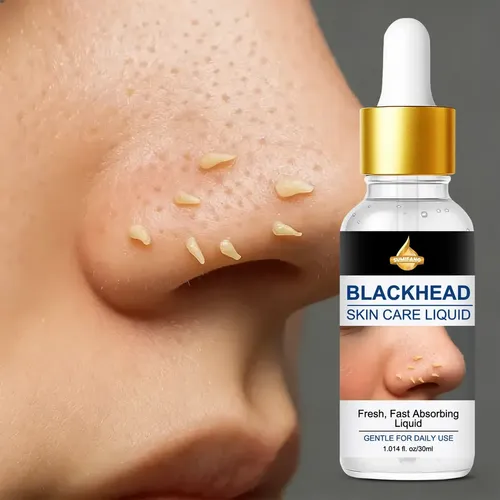 Sumifang Líquido Removedor De Puntos Negros 30ml Todo Tipo De Piel Día/noche
