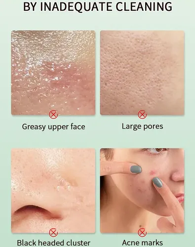 Gel Exfoliante De Almendras Ef Natural