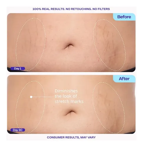 Crema Reafirmante Para El Vientre Gopure, Reafirmante Para E