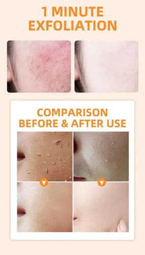 Exfoliante Corporal, Crema, Gel Para Citas, Exfoliante Facia Orange