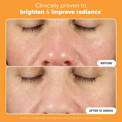 Cc Sérum Facial Vitamina C 15% Con Ácido Ferúlico