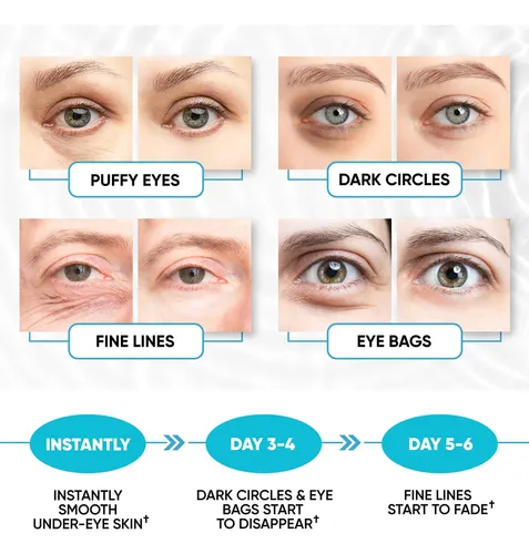 Parches Para Ojos Hinchados Y Ojeras Con Colágeno Y Ácido Hi