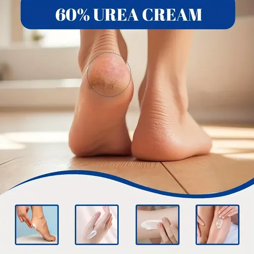 Crema Urea 60% Manos Y Pies Piel Seca Y Agrietada 300g Coconut Oil