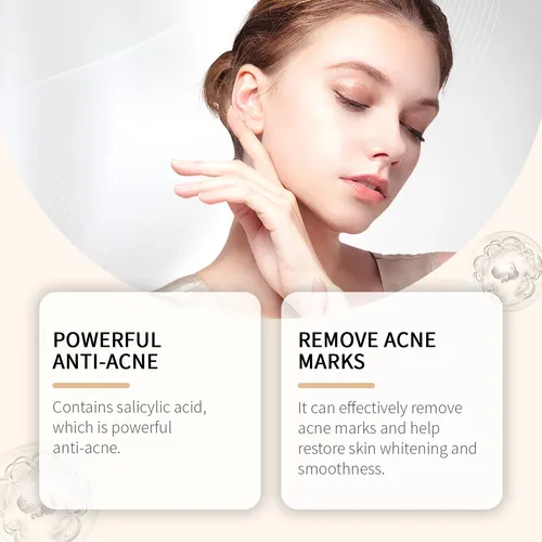 Gel Hidratante Eelhoe Oil-control Para Pieles Propensas Al A