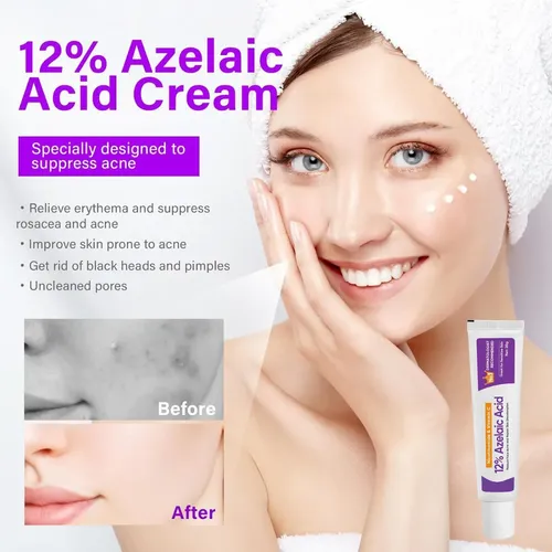 Crema Facial Con Ácido Azelaico 12% 20 G Para Acné Todo