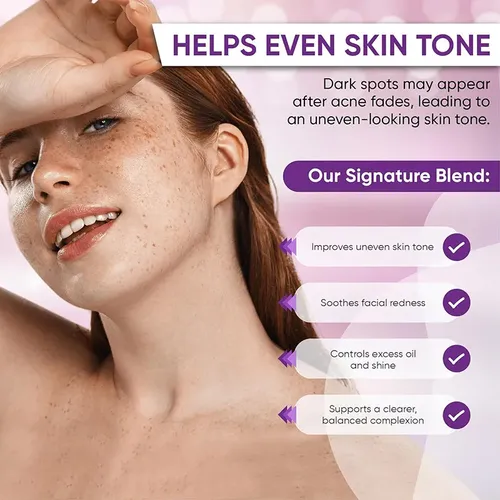 Crema Facial Ácido Azelaico 12% Niacinamida Antimanchas Acné