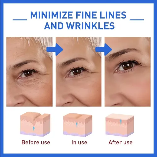 Botox Sérum Facial Hyalu B5 +lifting +antiage -arrugas
