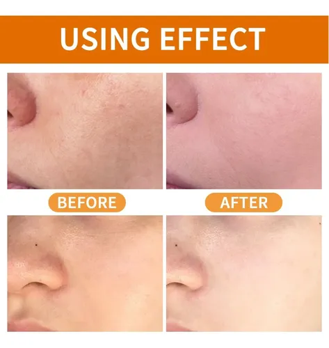 Gel Exfoliante Facial Naranja 60 G Puntos Negros Todo Tipo De Piel Día/noche