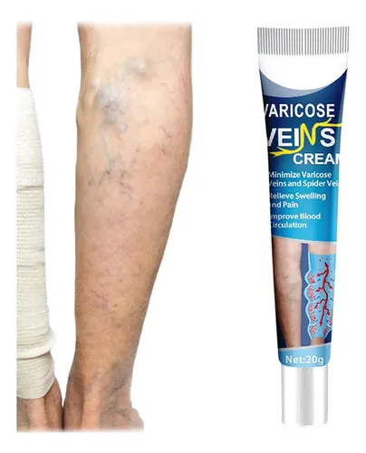 Crema Varices Piernas Cansadas 20 G Confort Piel Más Suave