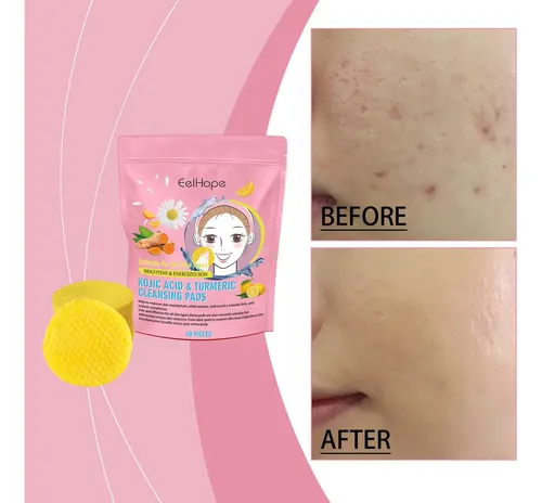 Curcuma Gentle Care Skincared Spotted Aligerante Y Nutritivo