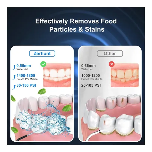 Hilo Dental De Agua Con 4 Modos Para Dientes