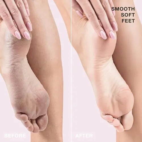 Starskin Fab Feet Fast Kit: Exfoliante+lima+crema