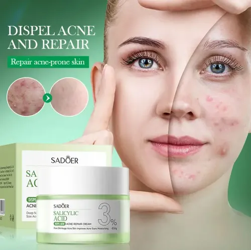 Sadoer Crema Facial Antiacne Acido Salicilo 3%