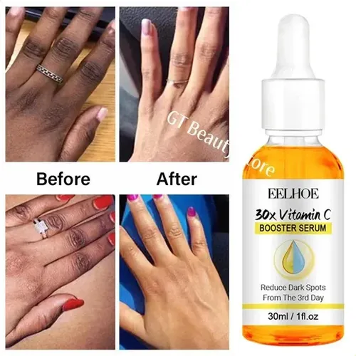Sérum Iluminador Dark Knuckles Para Codos, Rodillas Y Piel O