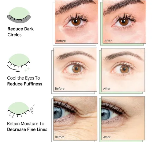 Parche Hidrogel Para Ojos Quia Con Colágeno 20 Pares
