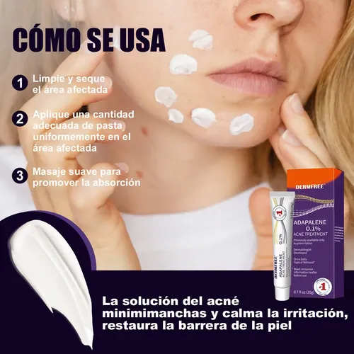 El Antiacné Facial Contiene Adapaleno Para Pieles Con Acné Z