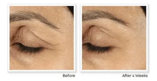 Crema De Ojos Suavizante Y Antienvejecimiento Para Ojeras Po