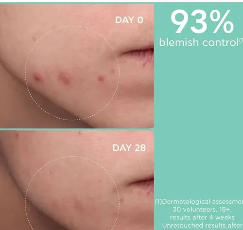 Apivita Locion Matificante Control Acne Just Bee Clear 40 Ml