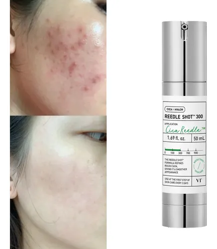 Esencia Facial Iluminadora Cuidado Piel 50 Ml Todo Tipo De Piel Día/noche