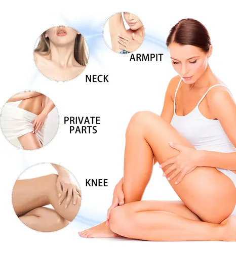 La Crema Blanqueadora Corporal Ouhoe Reduce La Opacidad De La Pie