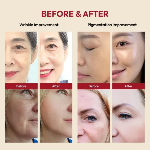 Serum Facial Retinal Liposomas 30ml Seoul 1988 Todo Tipo De Piel Día/noche