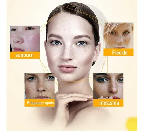 Crema Eliminadora De Manchas Oscuras Antienvejecimiento Para Día
