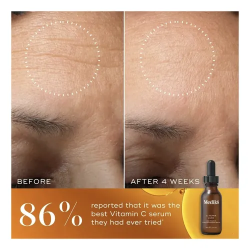 Serum Vitamina C Medik8 C-tetra Luxe 30ml Apto Sensibles