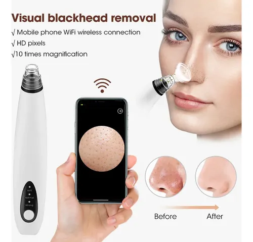 Cámara Inalámbrica Visual Blackhead Remover Deep Facial Ii N