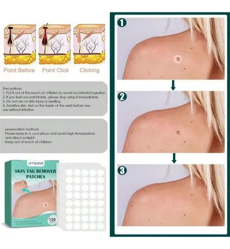 120 Parches Invisibles Para Eliminar El Acné Pimple Ii