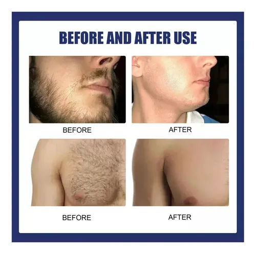 Aj 2×crema De Depilación Permanente-removedor De Barba Y
