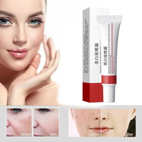 Crema Desvanecedora De Manchas Y Pecas Facial 20g