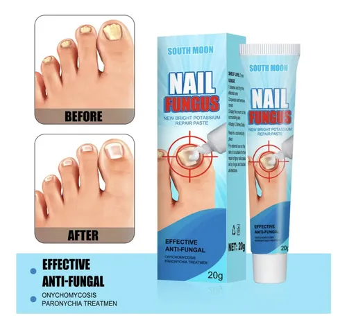 Crema Anti Hongos De Uñas Ataca Onicomicosis Pies Salud Fragancia Herbal