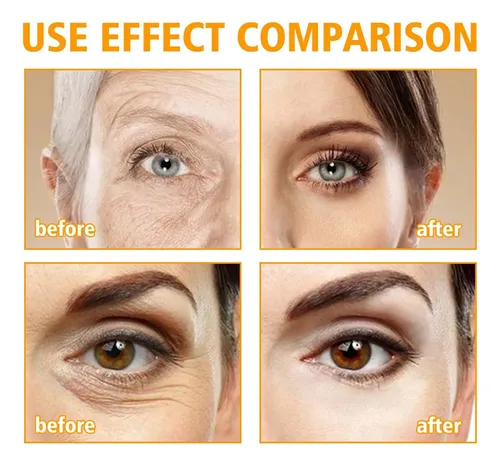 Crema Reparadora De Ojos 5d E Anting King 15 Ml
