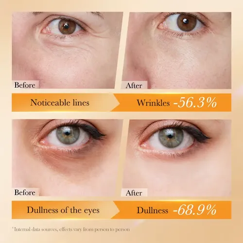 Kit Skincare Retinol Péptidos Rostro Y Ojos Antiarrugas