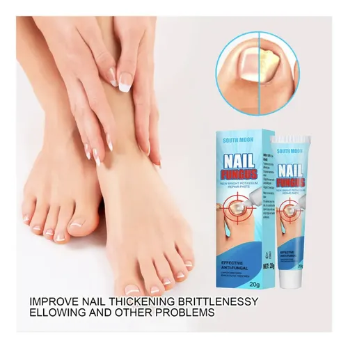Crema Anti Hongos De Uñas Ataca Onicomicosis Pies Salud Fragancia Herbal