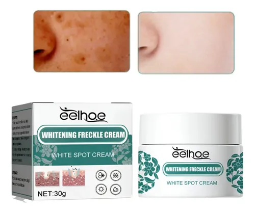 I Crema Iluminadora Facial Eelhoe Manchas Melasma Manchas Y