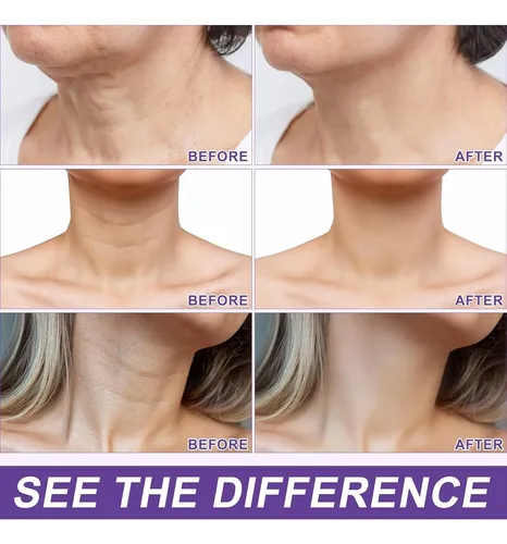 Crema Reafirmante Para El Cuello Ah-8 Con Rodillo