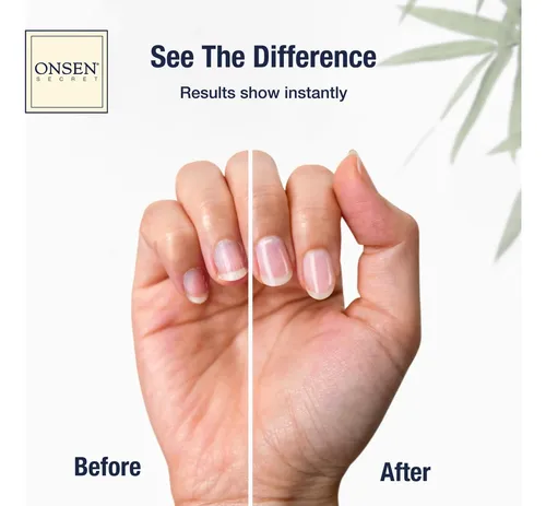 Tratamiento En Crema Para Uñas Y Cutículas Onsen Secret 15 M
