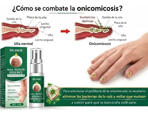 Reparador Ungueal Fortalecimiento Intensivo Pies Premium Transparente